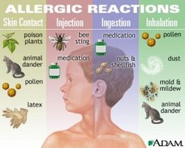 Allergy Reactions